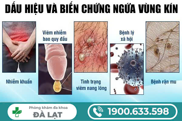 Hình ảnh minh họa